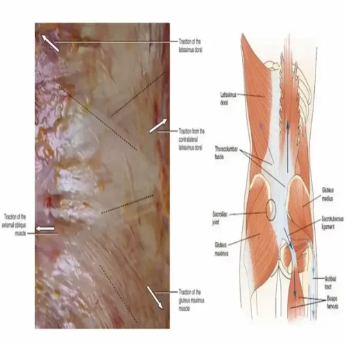 fascial restriction in 4 directions