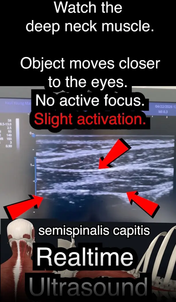 Cervical tissue assessment — diagnostic ultrasound, Heal Young Massage Gold Coast